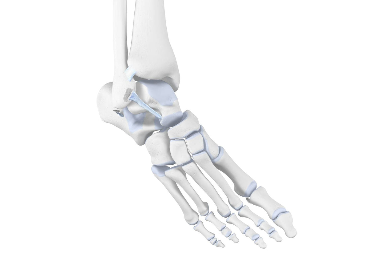What Is Ankle Distortion? - Bauerfeind United Kingdom